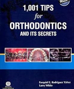 1001 Tips For Orthodontics And Its Secrets